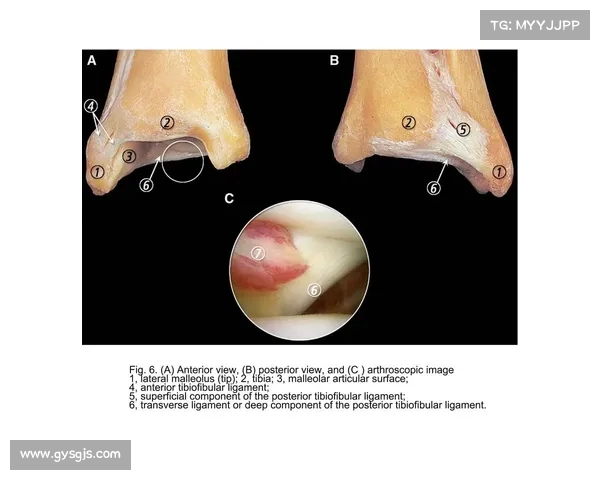 科瓦奇透露聚勒小腿不适排除踝关节韧带损伤问题 科瓦奇透露聚勒小腿不适排除踝关节韧带损伤问题